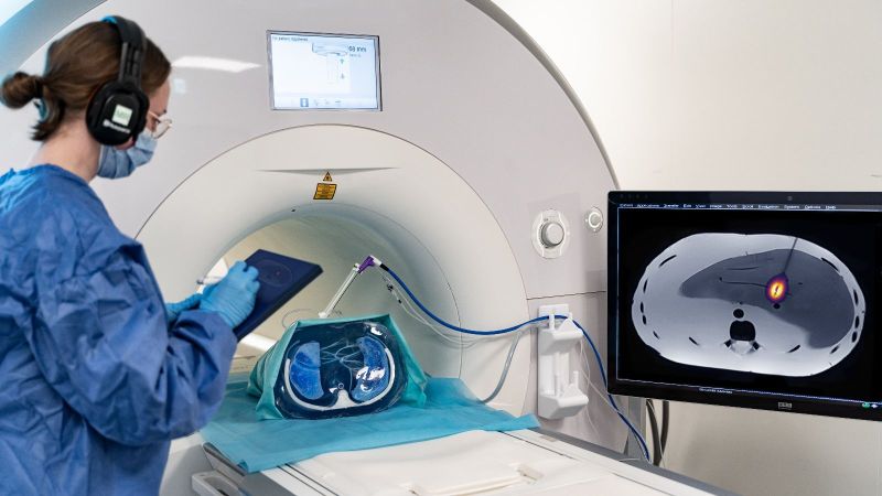 Eine Radiologin überwacht am Bildschirm die Hitzebehandlung durch die Ablationsnadel im Thorax-Phantom.